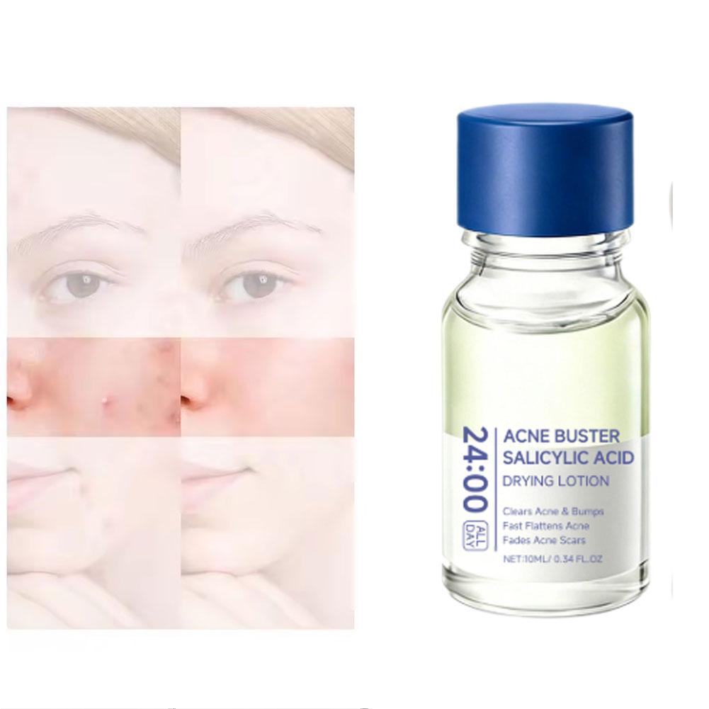Salicylic Acid Acne Care Serum - Azelaic Acid Serum recensione e prezzo