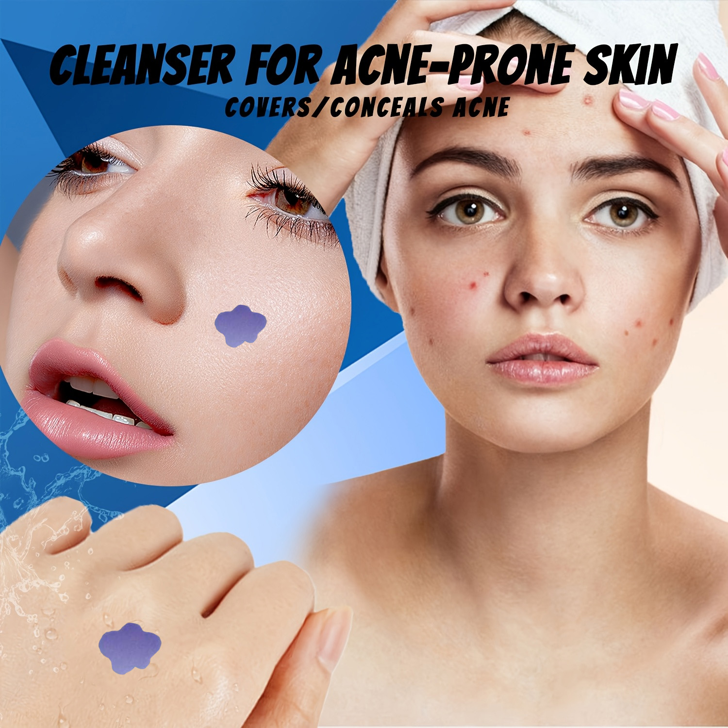 Microneedle Acne Pimple Patch  - Skincare You recensione e prezzo