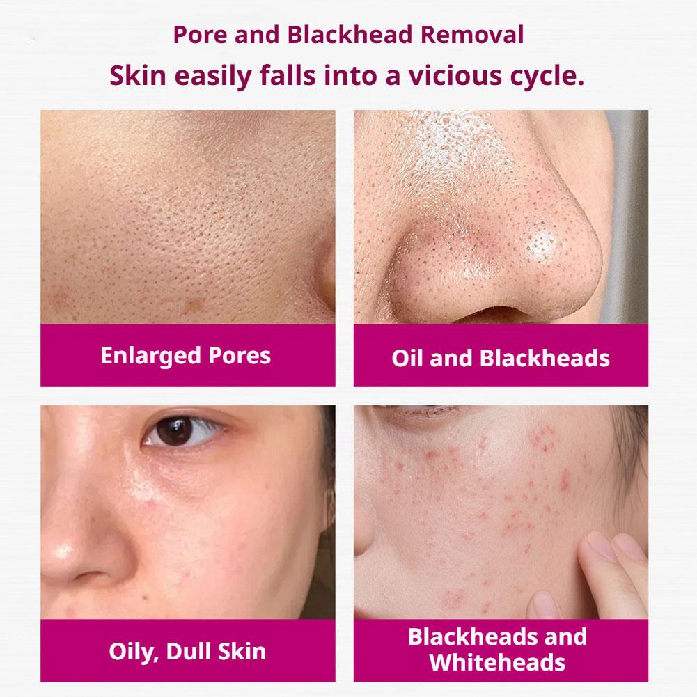 Salicylic Acid Shrink Pores Se - Tranexamic Acid Serum recensione e prezzo