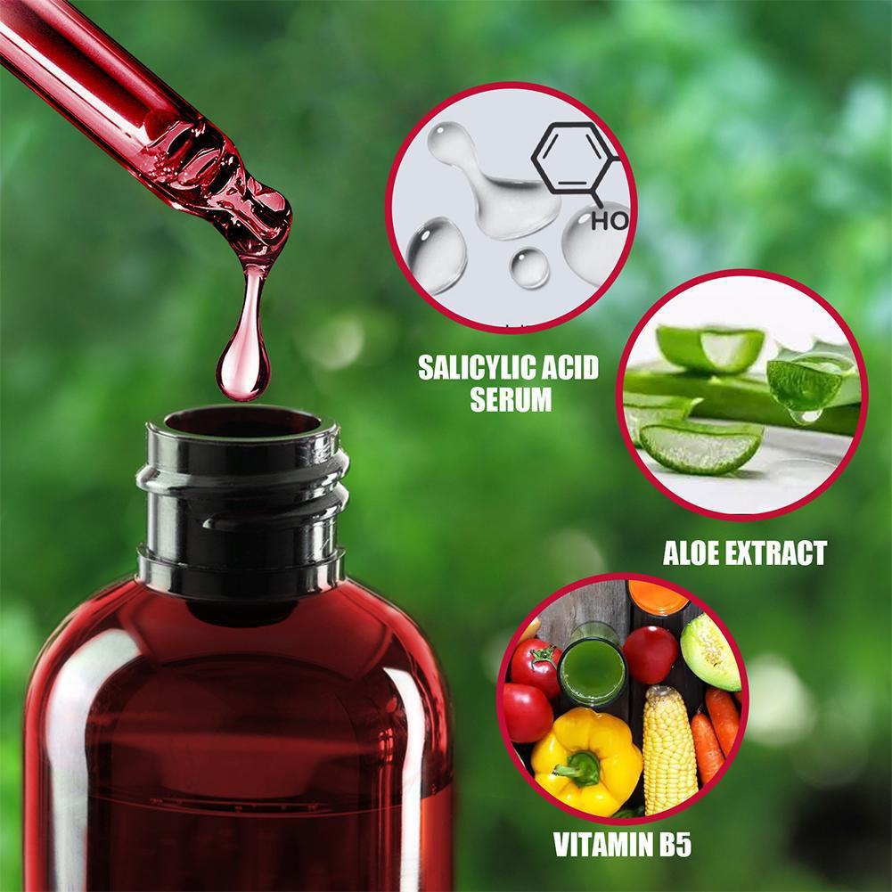 30ml Salicylic Acid Shrink Por - Azelaic Acid Serum recensione e prezzo