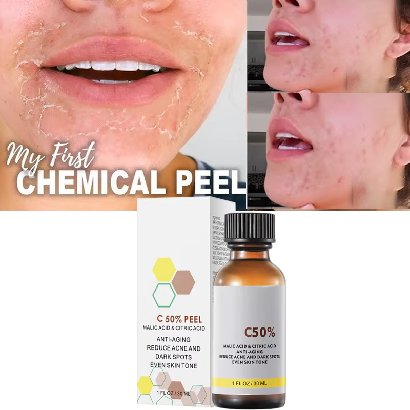 With Malic Acid And Citric Aci - Tranexamic Acid Serum recensione e prezzo