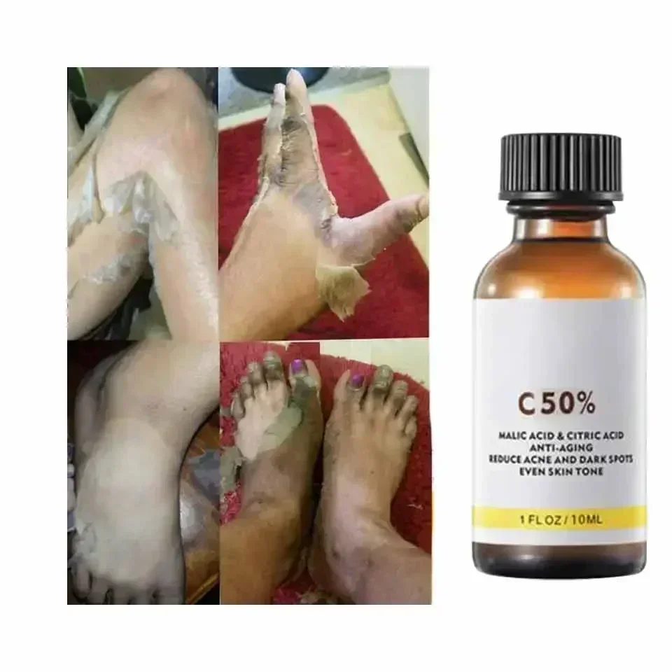 With Malic Acid And Citric Aci - Tranexamic Acid Serum recensione e prezzo